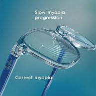 Myopia Lens Basics